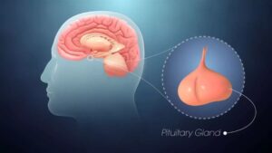 41 - Pituitary Gland Disorder